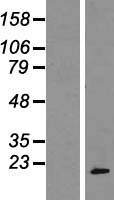 RPP20 (POP7) Human Over-expression Lysates NM_005837