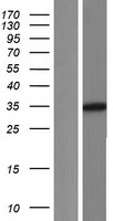 GLYAT Human Over-expression Lysates NM_201648