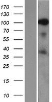 SRRM1 Human Over-expression Lysates NM_005839