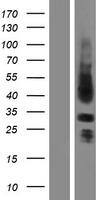 Sprouty 3 (SPRY3) Human Over-expression Lysates NM_005840