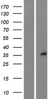 Sprouty 1 (SPRY1) Human Over-expression Lysates NM_005841