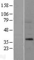 Sprouty 2 (SPRY2) Human Over-expression Lysates NM_005842