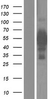IRX5 Human Over-expression Lysates NM_005853
