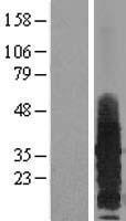 RAMP3 Human Over-expression Lysates NM_005856