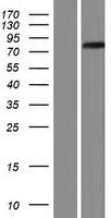 NET1 Human Over-expression Lysates NM_001047160