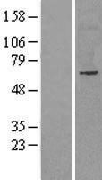 NET1 Human Over-expression Lysates NM_005863