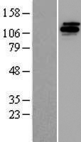 UBE4B Human Over-expression Lysates NM_006048