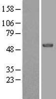 EFS Human Over-expression Lysates NM_032459
