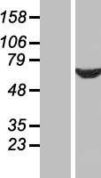SDCCAG10 (CWC27) Human Over-expression Lysates NM_005869