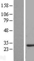 SMNDC1 Human Over-expression Lysates NM_005871