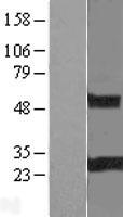 RGS19 Human Over-expression Lysates NM_001039467