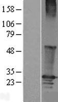 RGS19 Human Over-expression Lysates NM_005873