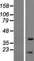 EIF1B Human Over-expression Lysates NM_005875