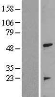 TRIP (TRAIP) Human Over-expression Lysates NM_005879