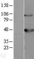 BCKDH kinase (BCKDK) Human Over-expression Lysates NM_005881