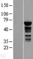 PAK4 Human Over-expression Lysates NM_001014831
