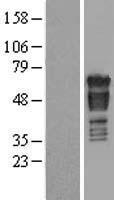ls010298 pak4 human over expression lysates nm 005884 wb testing 1