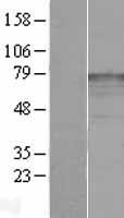 katanin p80 (KATNB1) Human Over-expression Lysates NM_005886
