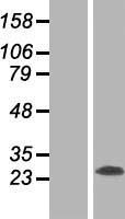 RTN3 Human Over-expression Lysates NM_006054