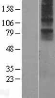NMUR1 Human Over-expression Lysates NM_006056