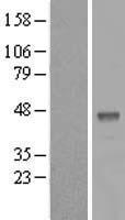 B3GALT5 Human Over-expression Lysates NM_006057