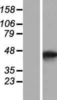 SMYD5 Human Over-expression Lysates NM_006062
