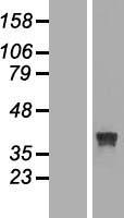 RRAGB Human Over-expression Lysates NM_006064