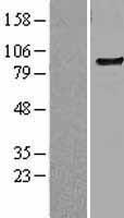 TLR6 Human Over-expression Lysates NM_006068