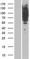 ls010335 irag1 human over expression lysates nm 001098579 wb testing 1