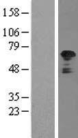 TRK fused gene (TFG) Human Over-expression Lysates NM_001007565