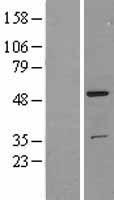 TRK fused gene (TFG) Human Over-expression Lysates NM_006070