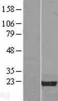 NPM3 Human Over-expression Lysates NM_006993