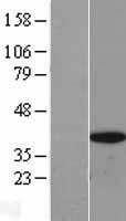 BRAF35 (HMG20B) Human Over-expression Lysates NM_006339