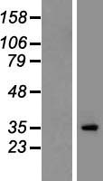 CACNG2 Human Over-expression Lysates NM_006078