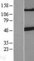 beta III Tubulin (TUBB3) Human Over-expression Lysates NM_006086