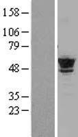 TUBB4B Human Over-expression Lysates NM_006088