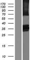 BTN2A2 Human Over-expression Lysates NM_001197239