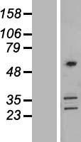 ls010391 coro2b human over expression lysates nm 006091 wb testing 2