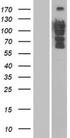 ls010395 dlc1 human over expression lysates nm 182643 wb testing 1