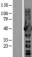 ls010397 ndrg1 human over expression lysates nm 001135242 wb testing 1