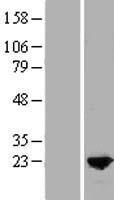 MYL9 Human Over-expression Lysates NM_006097