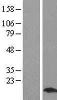 MYL9 Human Over-expression Lysates NM_181526