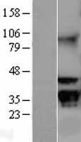 RACK1 Human Over-expression Lysates NM_006098