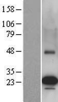PEAMT (PEMT) Human Over-expression Lysates NM_007169