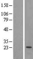 PEAMT (PEMT) Human Over-expression Lysates NM_148173