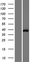 ST3GAL6 Human Over-expression Lysates NM_006100