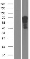 YAP1 Human Over-expression Lysates NM_001195044