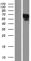 YAP1 Human Over-expression Lysates NM_006106