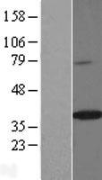 SPON2 Human Over-expression Lysates NM_001128325