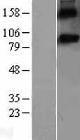 SPON1 Human Over-expression Lysates NM_006108